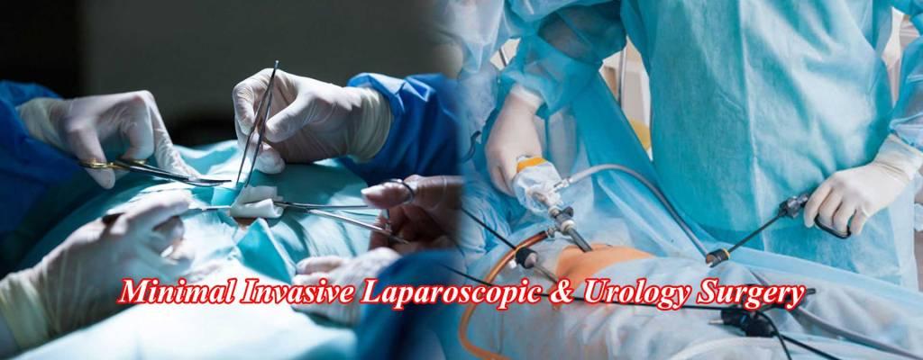 Minimal Invasive Surgery